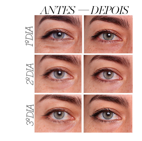 Círculos diabólicos em olhos