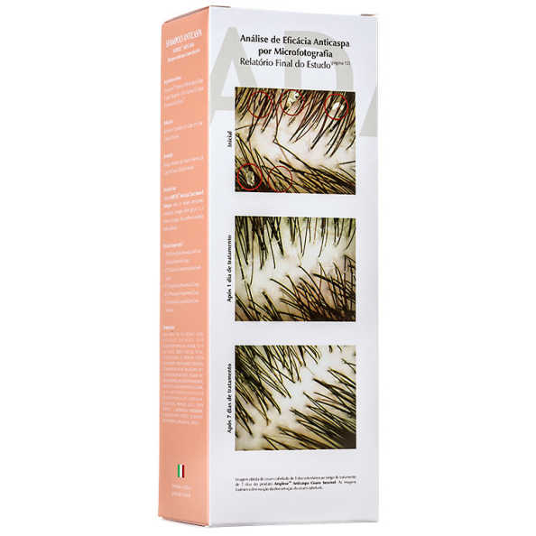Ada Tina Amplexe Anticaspa Couro Sensível - Shampoo 200ml